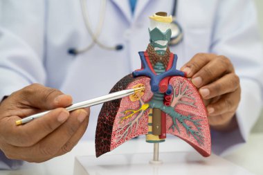 Zatürree, akciğer kanseri, Asyalı doktor hastanede teşhis ve tedavi için insan anatomisi modeli tutuyor.