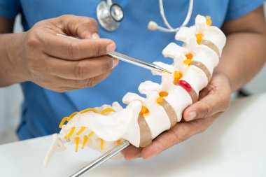 Omurga ve kemik modeli taşıyan Asyalı doktor, ortopedi bölümünde tedavi için bel kemiği yerinden oynamış disk parçası..
