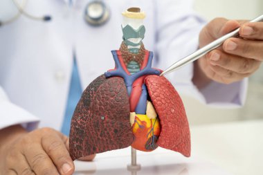 Zatürree, akciğer kanseri, Asyalı doktor hastanede teşhis ve tedavi için insan anatomisi modeli tutuyor.