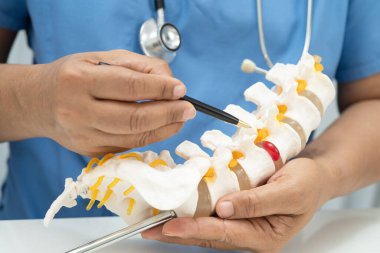 Omurga ve kemik modeli taşıyan Asyalı doktor, ortopedi bölümünde tedavi için bel kemiği yerinden oynamış disk parçası..