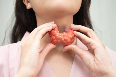 Hipertiroidizm, aşırı aktif tiroid, tiroid lenfoma, tiroid bezi insan anatomisi olan Asyalı kadın..