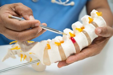 Omurga ve kemik modeli taşıyan Asyalı doktor, ortopedi bölümünde tedavi için bel kemiği yerinden oynamış disk parçası..