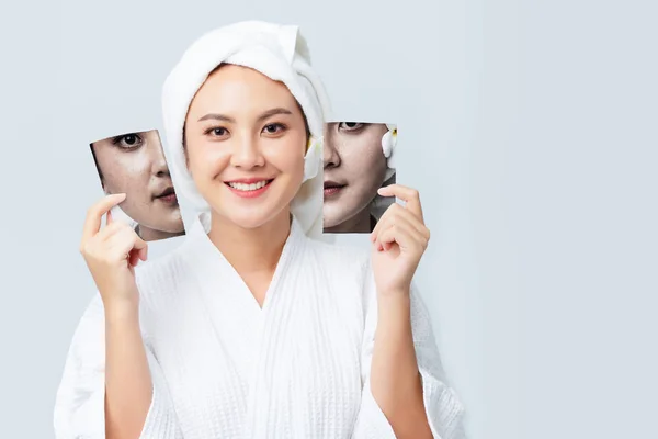 Vergelijking Van Portret Van Mooie Vrouw Voor Huidverzorging Clean Concept — Stockfoto