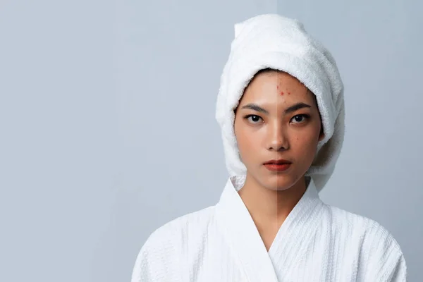 Porównanie Portret Pięknej Azjatyckiej Kobiety Ciemne Plamy Nowa Skóra Przed — Zdjęcie stockowe