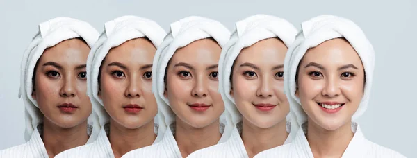 Jämförelse Porträtt Vacker Asiatisk Kvinna Mörka Fläckar Och Hud Före — Stockfoto