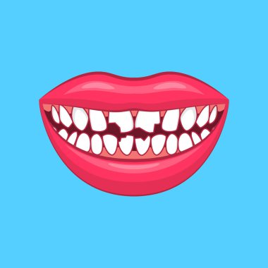 Gerçekçi detaylı 3d diş sorunu mavi üzerinde. Vektör