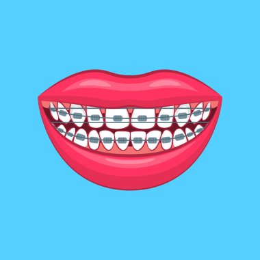 Gerçekçi detaylı 3d diş sorunu mavi üzerinde. Vektör