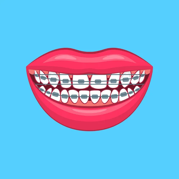 Realista Detallado problema dental 3d en un azul. Vector — Vector de stock