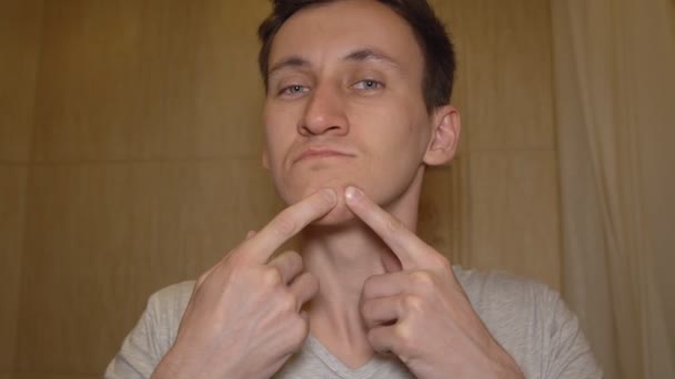 Jovem tenta espremer uma espinha em seu rosto — Vídeo de Stock