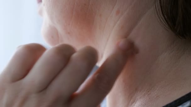Zbliżenie na dorosłej kobiety dotykając pieprzyk na jej szyi — Wideo stockowe