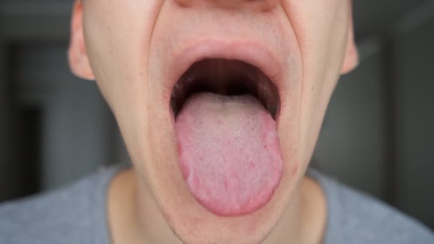 Close-up of man shows his mouth, tongue and teeth — Stock Video