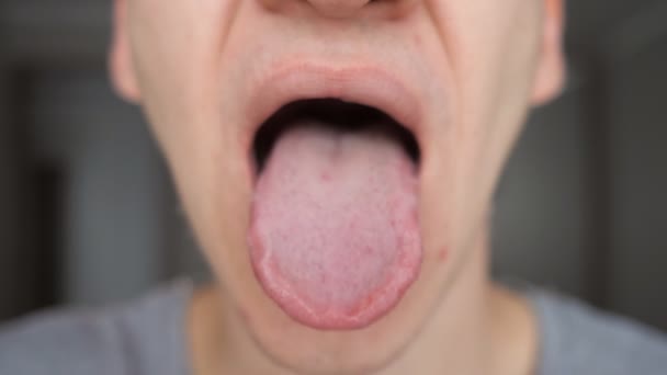 Homem tomando pílula, comprimido de drogas ou medicamentos na língua com a boca aberta — Vídeo de Stock