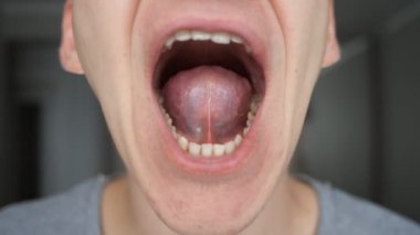adam onun ağız, dil ve diş gösterir.