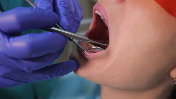 Dentist is taking care about patients tooth using electric dental brush, opening patients mouth closeup. Teeth care concept. — Stock Video