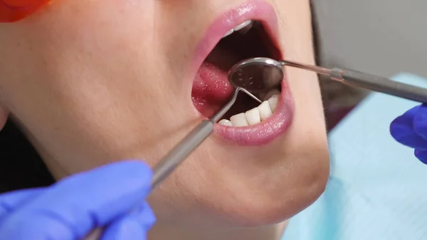 Dentist examines patients tooth with black cavity on it using dental tools and mirror.