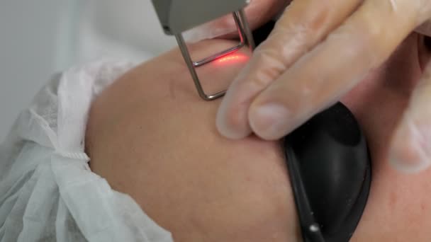 Mãos fazer rejuvenescimento a laser na testa da mulher vista de perto — Vídeo de Stock