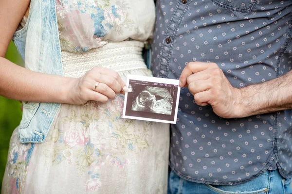 Bebeğin Ilk Resim Ultrason Resmini Karın Üzerinde Ultrason — Stok fotoğraf