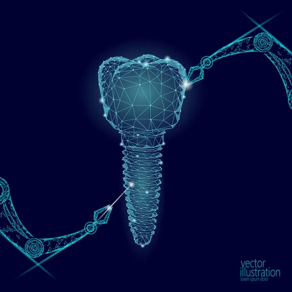 3d diente innovación robot brazo concepto poligonal. Estomatología símbolo de baja poli triángulo abstracto dental dental negocio de atención médica. El implante de partículas de punto conectado renderiza la ilustración del vector azul — Archivo Imágenes Vectoriales