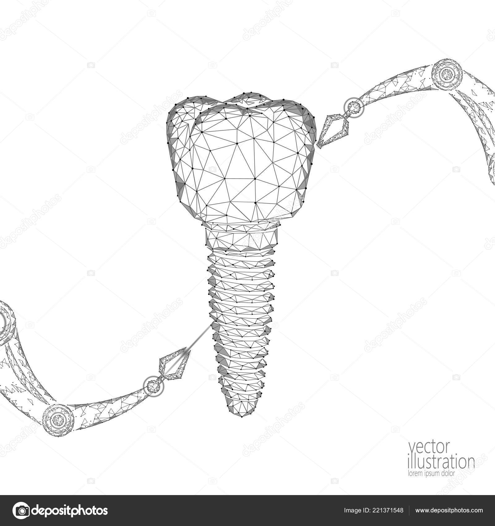 Foto de Conceito De Cirurgia De Rim 3d Renderização Isolado No