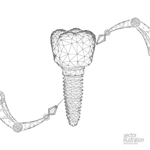 3 d 歯革新ロボット アーム多角形の概念。口腔病学シンボル低ポリ三角形抽象口腔歯科医療事業。接続ドット粒子インプラント レンダリング青ベクトル イラスト — ストックベクタ