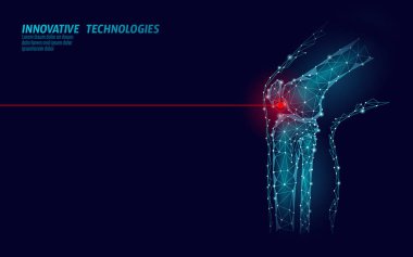 İnsan diz eklem 3d modeli illüstrasyon vektör. Düşük poli dizayn geleceğin teknolojisi tedavi ağrı tedavisi. Mavi arka plan ve kırmızı yaralanma adam vücut bacak tıp şablonu