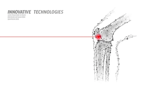 Human knee joint 3d model vector illustration. Low poly design future technology cure pain treatment. White background and red injury man body leg medicine template — Stock Vector
