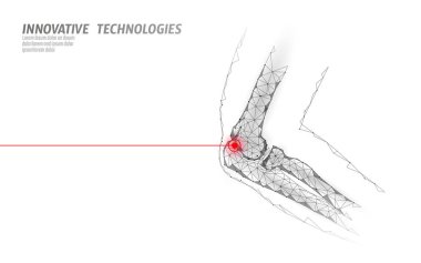 İnsan dirsek eklem 3d modeli illüstrasyon vektör. Düşük poli dizayn geleceğin teknolojisi tedavi ağrı tedavisi. Beyaz arka plan ve kırmızı yaralanma adam vücut kol tıp şablonu