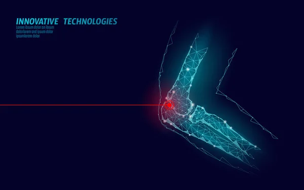 Codo humano articulación 3d modelo vector ilustración. El diseño de polietileno bajo tecnología futura cura el tratamiento del dolor. Plantilla de medicina de brazo de cuerpo de hombre de fondo azul y lesión roja — Vector de stock