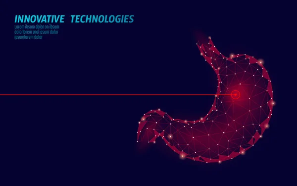 Menselijke maag laserchirurgie operatie laag poly. Medicijn ziekte behandeling pijnlijke gebied. Rode driehoeken veelhoekige 3D-weergave vorm. Apotheek business poster template vector illustratie — Stockvector
