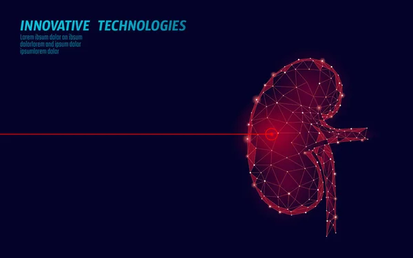 Rins humanos operação de cirurgia a laser baixo poli. Medicina doença tratamento medicamentoso área dolorosa. Triângulos vermelhos poligonais forma de renderização 3D. Farmácia pedras câncer recuperação modelo vetor ilustração —  Vetores de Stock