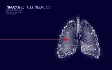 İnsan akciğer ameliyatı işlemi düşük poli lazer. Tıp hastalık ilaç tedavisi ağrılı alanı. Kırmızı üçgen poligon 3d şekil işlemek. Eczane tüberküloz kanser şablon vektör çizim