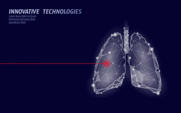 Menselijke longen laser chirurgie operatie laag poly. Geneeskunde ziekte drug behandeling pijnlijk gebied. Rode driehoeken veelhoekige 3d render vorm. Apotheek tuberculose kanker sjabloon vectorillustratie — Stockvector