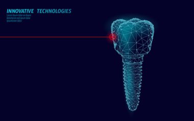 Diş implantı düşük Poli tıp kavramı. Stomatology yenilik teknoloji diş banner şablon vektör İllüstrasyonu