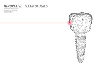 Diş implantı düşük Poli tıp kavramı. Stomatology yenilik teknoloji diş banner şablon vektör İllüstrasyonu