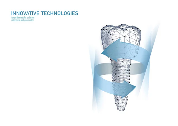 Implante dental molar modelo geométrico polivinílico bajo 3d. Odontología innovación tecnología futura titán hilo de metal. Salud médica ciencia poligonal punto línea vector ilustración — Vector de stock