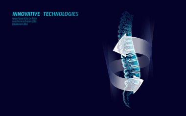 İnsan omurga yaralanması fizyoterapi koruması. Ağrı alanı cerrahi operasyon bakımı modern bel tıbbı teknolojisi düşük poli üçgenler. 3d render geri fıtık vektör illüstrasyon