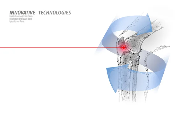 Emberi térd közös 3d modell vektoros illusztráció. Alacsony poly design a jövő technológiája gyógyítására fájdalom kezelés. Kék háttér és piros kár ember test láb gyógyszer sablon — Stock Vector