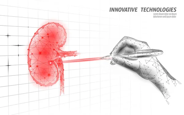 Emberi vese lézeres műtét alacsony poli. Gyógyszer betegség gyógyszeres kezelés fájdalmas terület. Piros háromszögek poligonális 3D render alakja. Gyógyszerészeti kövek rák helyreállítási sablon vektor illusztráció — Stock Vector