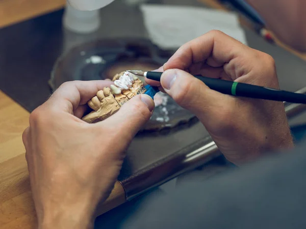 Dental technician applying enamel on mold — Stock Photo, Image