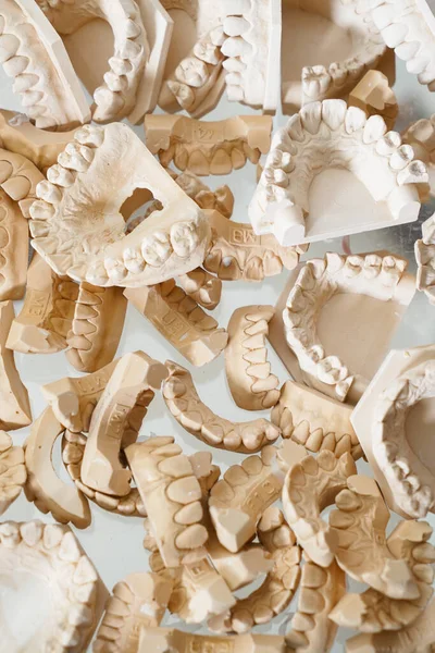 Horní Pohled Hromadu Různých Zubních Sádrokartonových Modelů Čelistí Laboratoři — Stock fotografie