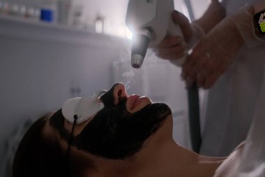Koruyucu gözlüklü ve cildine yeşil lazer ışığı takılı karbon lazer tedavisi gören bir kadının yakın çekimi. Derin temizlik ve gençleştirme için modern bir cilt bakımı..