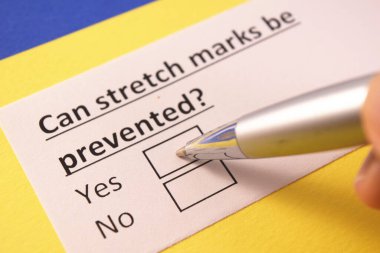 Gerilme izleri engellenebilir mi? Evet ya da hayır.?