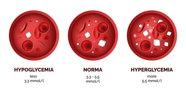 Infographic Image Blood Sugar Levels Isolated White Background Realistic Vector — Stock Vector