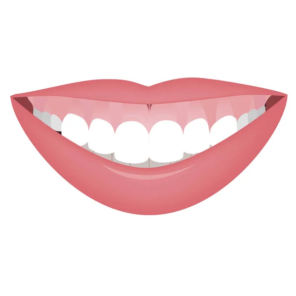 Bocca con una linea di sorriso alto o sorriso gommoso prima della correzione cosmetica, ortopedica o ortopedica. Illustrazione vettoriale — Vettoriale Stock