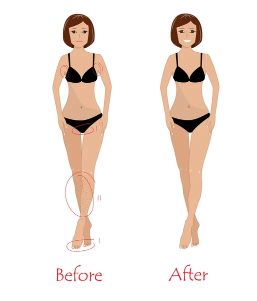 Woman epilation koncept - före och efter oönskade hårborttagning. Glad tjej efter armhåla, bikini och ben epilering. Vektorillustration — Stock vektor