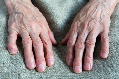 Yaşlı bir kadın buruşuk çalışma elleri. Gövde bölümü.