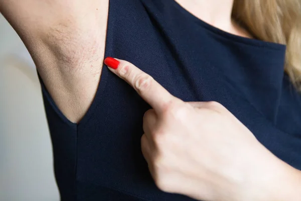 Female Finger Shows Unshaven Armpit Body Care — Stock Photo, Image