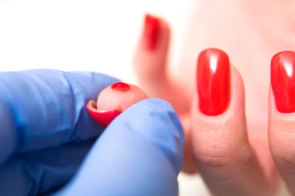 Girl with a red manicure gives a blood test from a finger. Close-up.