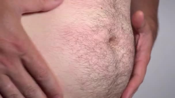 Άντρας με πρωτοπαθή παχυσαρκία δείχνει κοιλιά μπύρας — Αρχείο Βίντεο