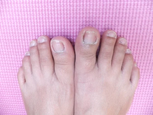 Feet Pink Mat — Stock Photo, Image